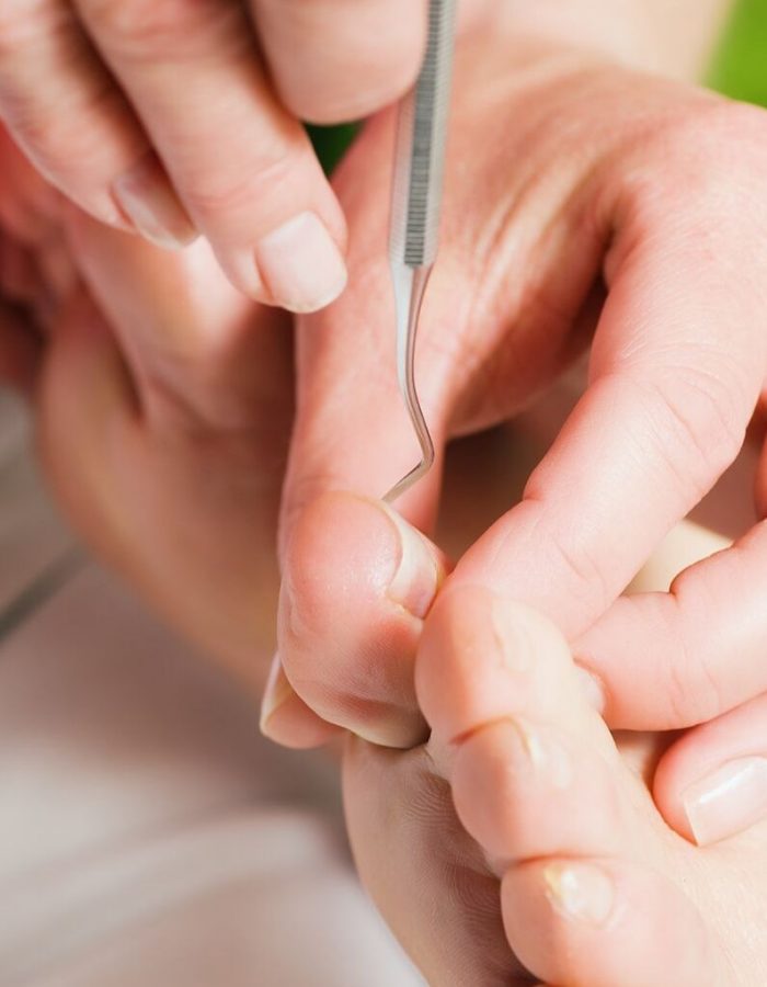 Nail Bed Injury: Healing Time & Treatments